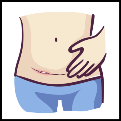Wound Care After Caesarean Section